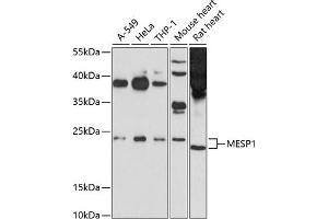 Western blot analysis of extracts of various cell lines, using MESP1 antibody (ABIN6131056, ABIN6143747, ABIN6143748 and ABIN6214298) at 1:1000 dilution. (MESP1 Antikörper  (AA 149-268))