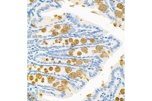 Immunohistochemistry of paraffin embedded mouse colon using CNTROB (ABIN7073427) at dilution of 1:200 (400x lens) (CNTROB Antikörper)