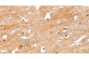 Immunohistochemistry of paraffin-embedded Human brain tissue using S100B Polyclonal Antibody at dilution 1:50 (S100B Antikörper)