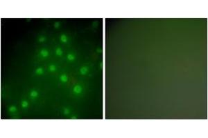 Immunofluorescence analysis of HepG2 cells, using HDAC9 Antibody. (HDAC9 Antikörper  (AA 1017-1066))