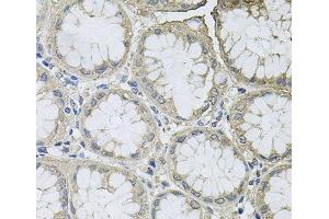 Immunohistochemistry of paraffin-embedded Human stomach using BCL2L2 Polyclonal Antibody at dilution of 1:100 (40x lens). (BCL2L2 Antikörper)