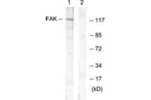 Western blot analysis of extracts from HeLa cells, treated with EGF 200ng/ml 30', using FAK (Ab-407) Antibody. (FAK Antikörper  (AA 373-422))