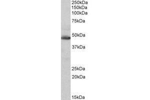 Western Blotting (WB) image for anti-Isocitrate Dehydrogenase 2 (NADP+), Mitochondrial (IDH2) (AA 418-429) antibody (ABIN1496056) (IDH2 Antikörper  (AA 418-429))