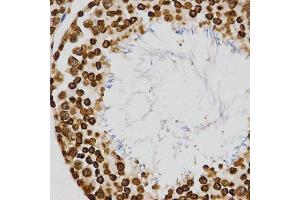 Immunohistochemistry (Paraffin-embedded Sections) (IHC (p)) image for anti-Histone H4 (3meLys20) antibody (ABIN3016051)