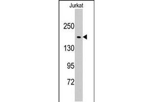Western blot analysis of EPRS polyclonal antibody  in Jurkat cell line lysates (35 ug/lane). (EPRS Antikörper  (N-Term))