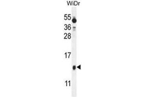 BEX1 Antibody (Center) western blot analysis in WiDr cell line lysates (35µg/lane). (BEX1 Antikörper  (Middle Region))