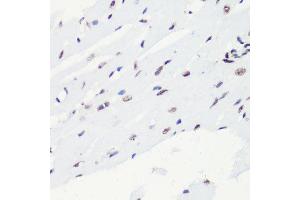 Immunohistochemistry (Paraffin-embedded Sections) (IHC (p)) image for anti-Histone H4 (2meLys20) antibody (ABIN3016048)