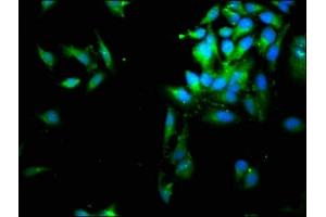 Immunofluorescence staining of Hela cells with ABIN7158247 at 1:66, counter-stained with DAPI.