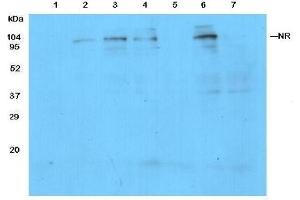 Detection of NR in protein extracts from leaves of Columbia (1) and NR knockout(2-3) mutants of Arabidopsis thaliana. (Nitrate Reductase Antikörper)