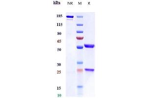 Anti-IL-4 Reference Antibody (pascolizumab) on SDS-PAGE under reducing (R) condition.