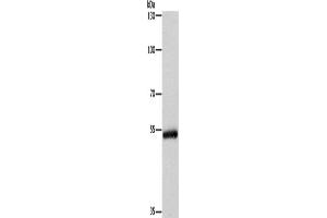 Western Blotting (WB) image for anti-Cytochrome P450, Family 2, Subfamily B, Polypeptide 6 (CYP2B6) antibody (ABIN2432914) (CYP2B6 Antikörper)