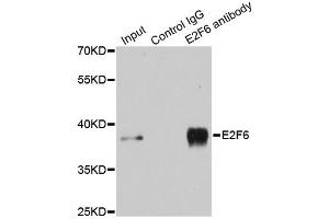 Immunoprecipitation analysis of 200ug extracts of MCF-7 cells using 3ug E2F6 antibody (ABIN6290326).