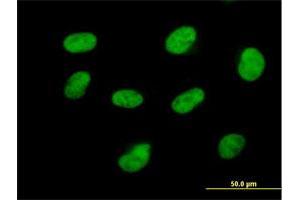 Immunofluorescence of purified MaxPab antibody to CDK7 on HeLa cell. (CDK7 Antikörper  (AA 1-346))