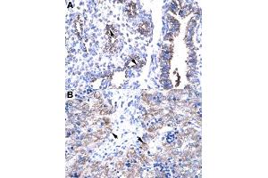 Immunohistochemical staining (Formalin-fixed paraffin-embedded sections) of human lung (A) and human liver (B) with HTATIP2 polyclonal antibody  at 4-8 ug/mL working concentration. (HIV-1 Tat Interactive Protein 2, 30kDa (HTATIP2) (N-Term) Antikörper)