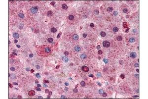 AP22624PU-N AKT antibody staining of Formalin-Fixed Paraffin-Embedded Human Liver at 1/100 followed by Biotin conjugated Goat anti-Rabbit IgG secondary antibody, Alkaline Phosphatase-Streptavidin and Chromogen. (AKT1 Antikörper  (C-Term))