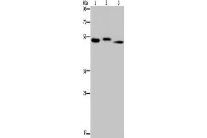Western Blotting (WB) image for anti-Hyaluronidase-3 (HYAL3) antibody (ABIN2423631) (HYAL3 Antikörper)