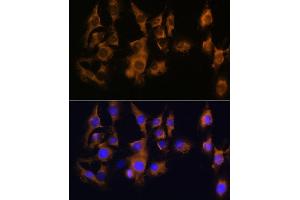 Immunofluorescence analysis of C6 using SPRR3 antibody (ABIN6130714, ABIN6148386, ABIN6148387 and ABIN6215609) at dilution of 1:100 (40x lens). (SPRR3 Antikörper  (AA 1-70))