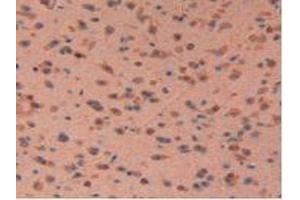 IHC-P analysis of Mouse Brain Tissue, with DAB staining. (LIFR Antikörper  (AA 381-485))