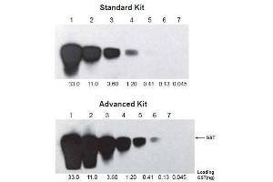 Two similar blots were processed with the same procedures using different ONE-HOUR WesternTM Kits: Standard (ABIN491508) and Advanced (ABIN491500). (ONE-HOUR Western Basic Kit (Maus))