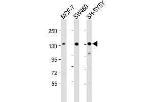 All lanes : Anti-SRG Antibody (C-term) at 1:2000 dilution Lane 1: MCF-7 whole cell lysate Lane 2: S whole cell lysate Lane 3: SH-SY5Y whole cell lysate Lysates/proteins at 20 μg per lane. (SRGAP2 Antikörper  (C-Term))