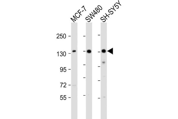 SRGAP2 Antikörper  (C-Term)