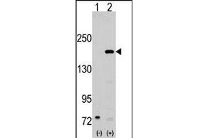 Western blot analysis of SRC1 (arrow) using rabbit NCOA1 polyclonal antibody . (NCOA1 Antikörper  (N-Term))