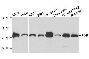 Western blot analysis of extracts of various cell lines, using POR antibody. (POR Antikörper  (AA 1-250))