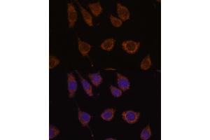 Immunofluorescence analysis of L929 cells using CB antibody (ABIN7266072) at dilution of 1:100. (CA5B Antikörper  (AA 1-317))
