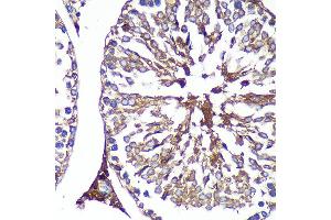 Immunohistochemistry (IHC) image for anti-PAS Domain Containing Serine/threonine Kinase (PASK) (AA 1194-1323) antibody (ABIN6145248)