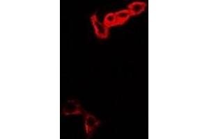 Immunofluorescent analysis of MOCS3 staining in A549 cells. (MOCS3 Antikörper)
