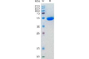 SDS-PAGE (SDS) image for Interleukin 5 (IL5) (AA 20-134) protein (Fc Tag) (ABIN7092704)