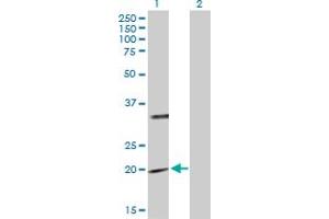 Western Blot analysis of PTPMT1 expression in transfected 293T cell line by PTPMT1 MaxPab polyclonal antibody. (PTPMT1 Antikörper  (AA 1-201))