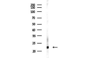 Western blot analysis of lysates from K562 cells(UV 30 min treatment), using RBPMS2 Antibody at 1/1000 dilution.