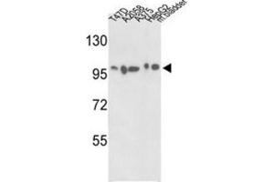 Western Blotting (WB) image for anti-Actinin, alpha 4 (ACTN4) antibody (ABIN3003494) (alpha Actinin 4 Antikörper)