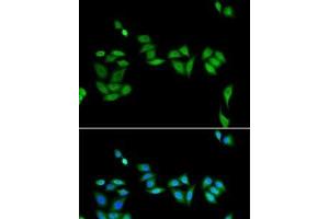 Immunofluorescence analysis of U2OS cells using JADE1 Polyclonal Antibody (PHF17 Antikörper)