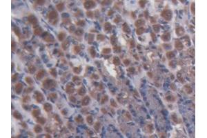 Immunohistochemistry (IHC) image for anti-Membrane Protein, Palmitoylated 3 (MAGUK P55 Subfamily Member 3) (MPP3) (AA 385-570) antibody (ABIN5013921)