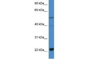 WB Suggested Anti-IL18 AntibodyTitration: 1. (IL-18 Antikörper  (C-Term))