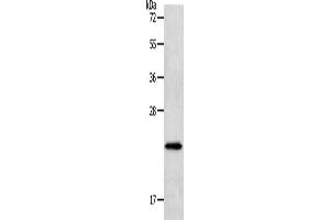 Gel: 12 % SDS-PAGE, Lysate: 40 μg, Lane: Human liver cancer tissue, Primary antibody: ABIN7191632(NEUROG1 Antibody) at dilution 1/400, Secondary antibody: Goat anti rabbit IgG at 1/8000 dilution, Exposure time: 1 minute (Neurogenin 1 Antikörper)