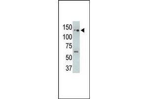 The anti-USP25 N-term Pab (ABIN388917 and ABIN2839196) is used in Western blot to detect USP25 in USP25-transfected HeLa cell lysates. (USP25 Antikörper  (N-Term))