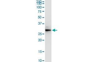 VAPA monoclonal antibody (M01), clone 4C12. (VAPA Antikörper  (AA 1-242))