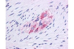 GLUD1 antibody was used for immunohistochemistry at a concentration of 4-8 ug/ml. (GLUD1 Antikörper  (N-Term))