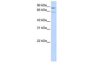 Factor XIII B Polypeptide antibody used at 1 ug/ml to detect target protein. (F13B Antikörper  (Middle Region))