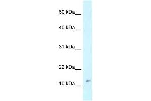 Western Blot showing RPL37 antibody used at a concentration of 1 ug/ml against MCF7 Cell Lysate (RPL37 Antikörper  (Middle Region))