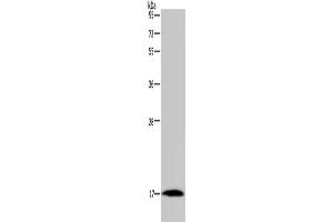 Gel: 10 % SDS-PAGE, Lysate: 40 μg, Lane: Mouse heart tissue, Primary antibody: ABIN7191408(MARVELD1 Antibody) at dilution 1/300, Secondary antibody: Goat anti rabbit IgG at 1/8000 dilution, Exposure time: 10 minutes (MARVELD1 Antikörper)