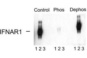 Image no. 2 for anti-Interferon alpha/beta Receptor 1 (IFNAR1) (pSer535), (Ser539) antibody (ABIN228236) (IFNAR1 Antikörper  (pSer535, Ser539))