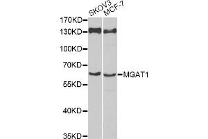 Western blot analysis of extracts of various cell lines, using MGAT1 antibody (ABIN6293367) at 1:1000 dilution. (MGAT1 Antikörper)
