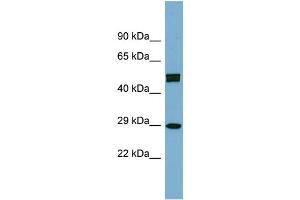 WB Suggested Anti-HOXC8 Antibody Titration: 0. (HOXC8 Antikörper  (Middle Region))