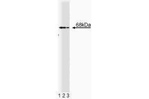 Western blot analysis of PTP1C on Jurkat cell lysate. (SHP1 Antikörper  (AA 492-597))