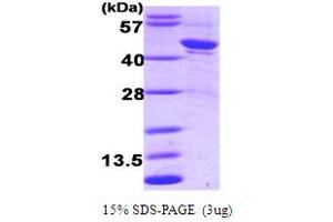 SDS-PAGE (SDS) image for serpin Peptidase Inhibitor, Clade A (Alpha-1 Antiproteinase, Antitrypsin), Member 1 (SERPINA1) (AA 25-418) protein (ABIN667090)