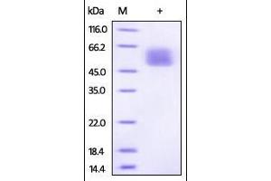 SDS-PAGE (SDS) image for Interleukin 13 Receptor, alpha 1 (IL13RA1) (AA 26-340) protein (His tag) (ABIN2181339) (IL13 Receptor alpha 1 Protein (AA 26-340) (His tag))
